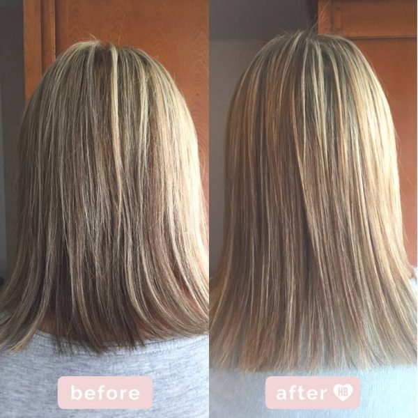 قبل و بعد از کپسول ویتامینه و رشد مو هیربرست Hairburst