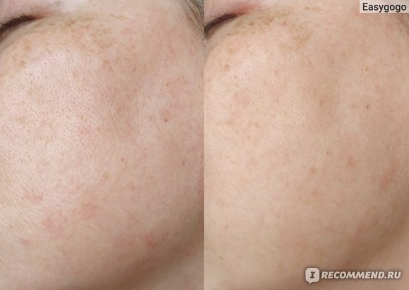 قبل و بعد از پرایمر مات کننده شیسیدو Shiseido