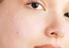 علت پیل شدن ضد آفتاب چیست؟